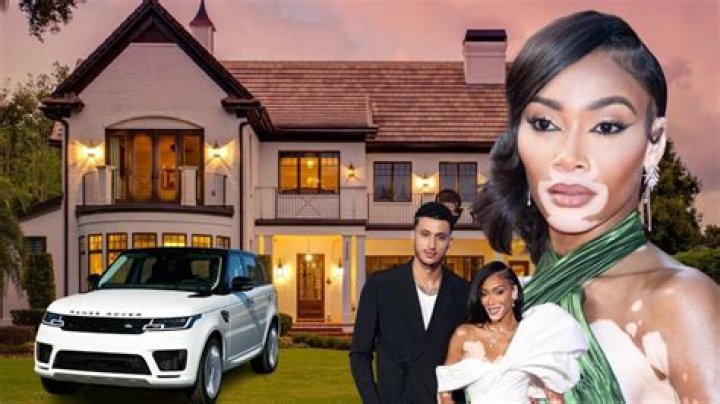 Winnie Harlow Biography, Age, Height, Husband, Net Worth, Family